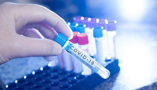 Новите случаи на COVID 19 за изминалото денонощие у нас са